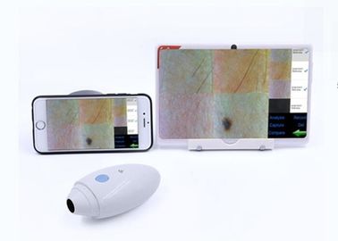 HD digitale VideodieDermatoscope-de Scannerradio van het Huidhaar aan Mobilophone Gesteunde IOS Andriod wordt aangesloten