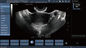 Transvaginal de Ultrasone klankscanner van Doppler van de Sonde Mobiele Kleur voor Zwangerschap
